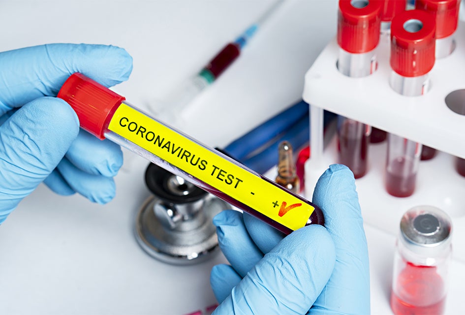 The coronavirus antibody tests help public health officials better understand how much the virus has penetrated society. 